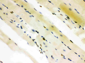 CTBP2 Antibody