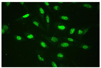 CTBP2 Antibody