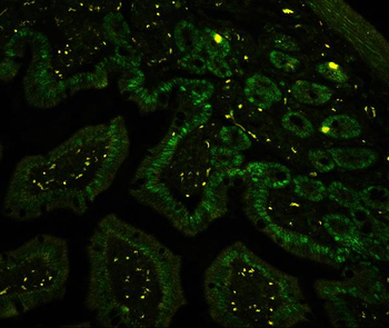 CTBP2 Antibody