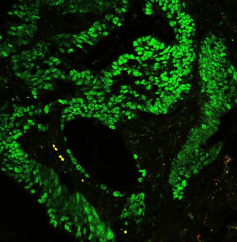 CTBP2 Antibody