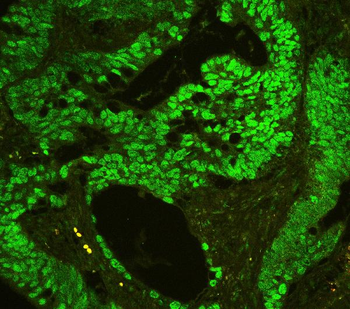 CTBP2 Antibody