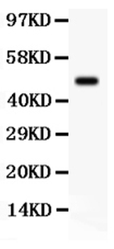 SGK1 Rabbit Polyclonal Antibody