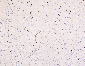 Glucose Transporter GLUT1/SLC2A1 Antibody