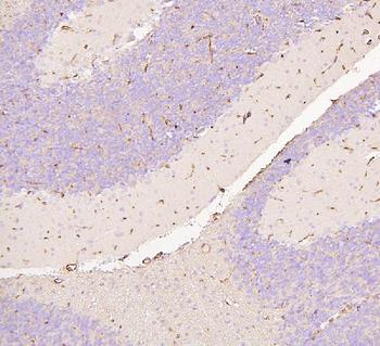 Glucose Transporter GLUT1/SLC2A1 Antibody