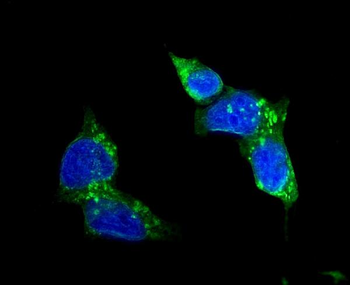 Glucose Transporter GLUT1/SLC2A1 Antibody