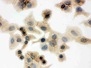 Glucose Transporter GLUT1/SLC2A1 Antibody