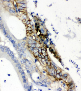 Glucose Transporter GLUT1/SLC2A1 Antibody