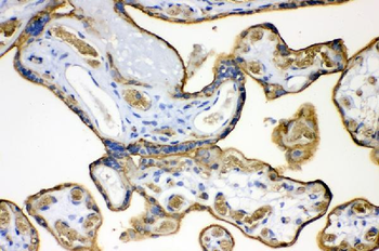 Glucose Transporter GLUT1/SLC2A1 Antibody