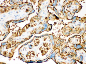 Glucose Transporter GLUT1/SLC2A1 Antibody
