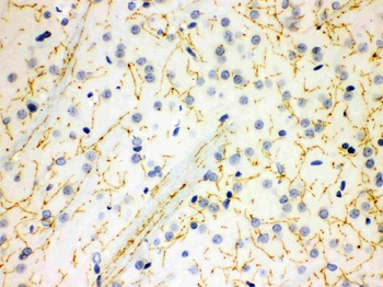 Serotonin transporter/SLC6A4 Rabbit Polyclonal Antibody
