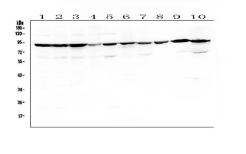 Serotonin transporter/SLC6A4 Rabbit Polyclonal Antibody