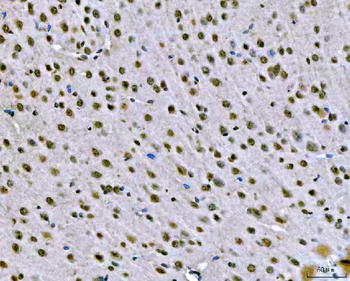 SNRPN Antibody