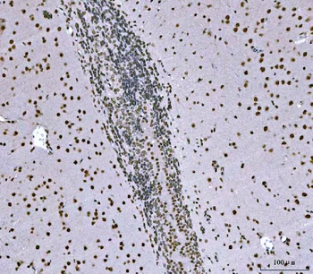SNRPN Antibody