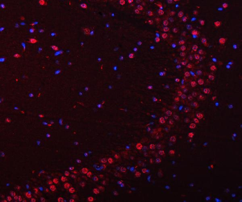 SNRPN Antibody