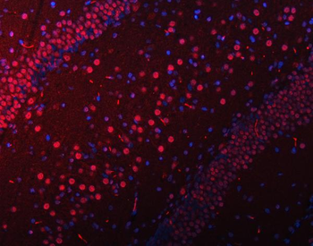 SNRPN Antibody