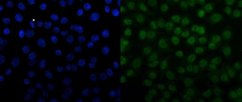 SNRPN Antibody