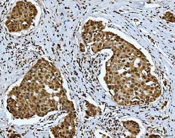 SNRPN Antibody