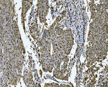 SNRPN Antibody
