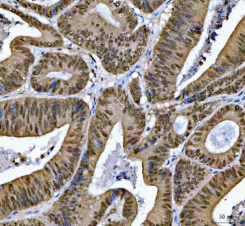 SNRPN Antibody