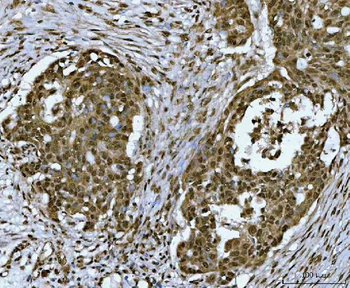 SNRPN Antibody