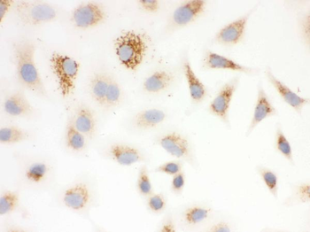 SOD2 Rabbit Polyclonal Antibody