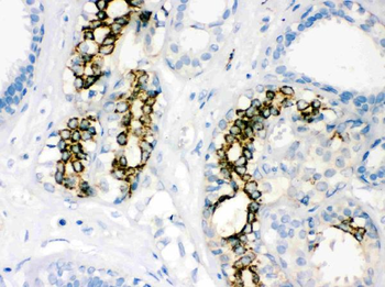 SOD2 Rabbit Polyclonal Antibody