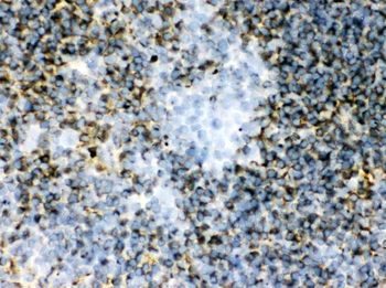 Transglutaminase 2/TGM2 Antibody