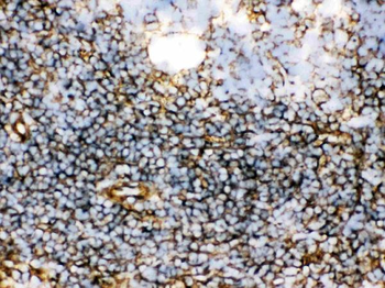 Transglutaminase 2/TGM2 Antibody