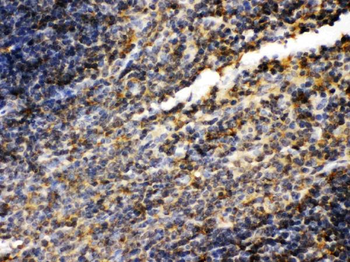 Transglutaminase 2/TGM2 Antibody
