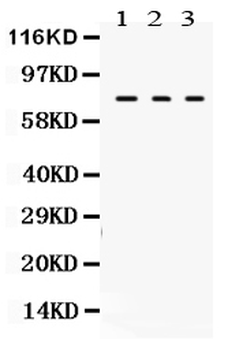 Transglutaminase 2/TGM2 Antibody