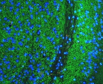 Tyrosine Hydroxylase/TH Rabbit Polyclonal Antibody