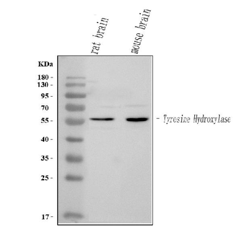 Tyrosine Hydroxylase/TH Rabbit Polyclonal Antibody