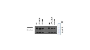 Versican/VCAN Rabbit Polyclonal Antibody