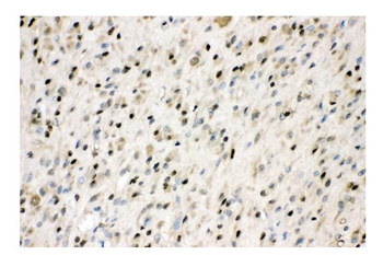 VCP Antibody