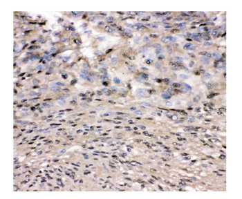 VCP Antibody