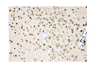 VCP Antibody