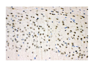 VCP Antibody