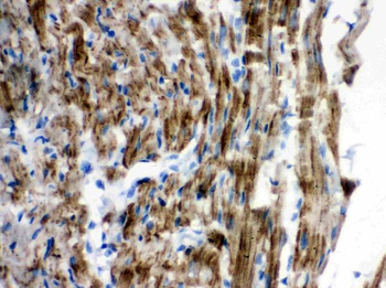 VDAC/Porin/VDAC1 Antibody