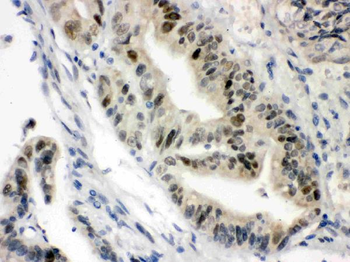 Vitamin D Receptor/VDR Antibody