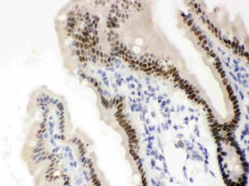 Vitamin D Receptor/VDR Antibody