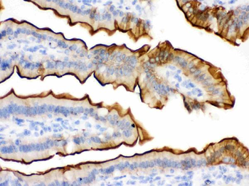 Villin/VIL1 Antibody