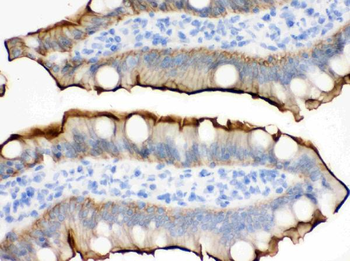 Villin/VIL1 Antibody