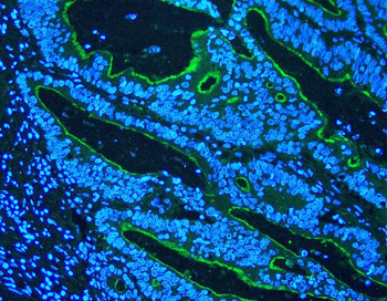 Villin/VIL1 Antibody