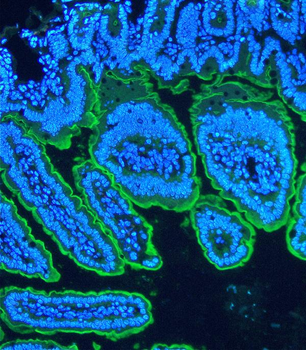Villin/VIL1 Antibody
