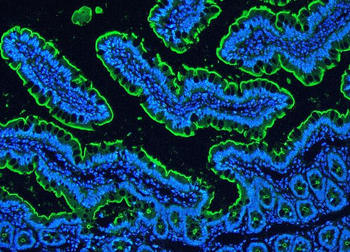 Villin/VIL1 Antibody
