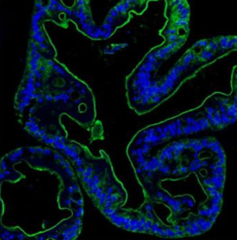 Villin/VIL1 Antibody