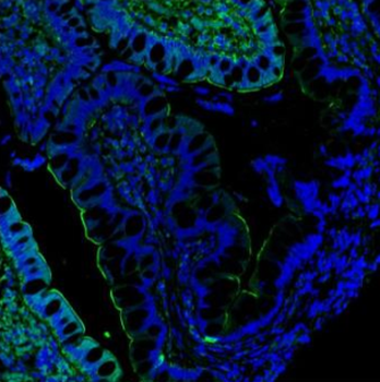 Villin/VIL1 Antibody
