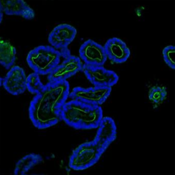 Villin/VIL1 Antibody