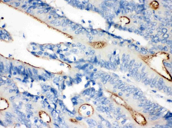 Villin/VIL1 Antibody