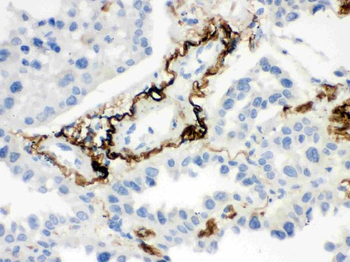 Vitronectin/VTN Rabbit Polyclonal Antibody